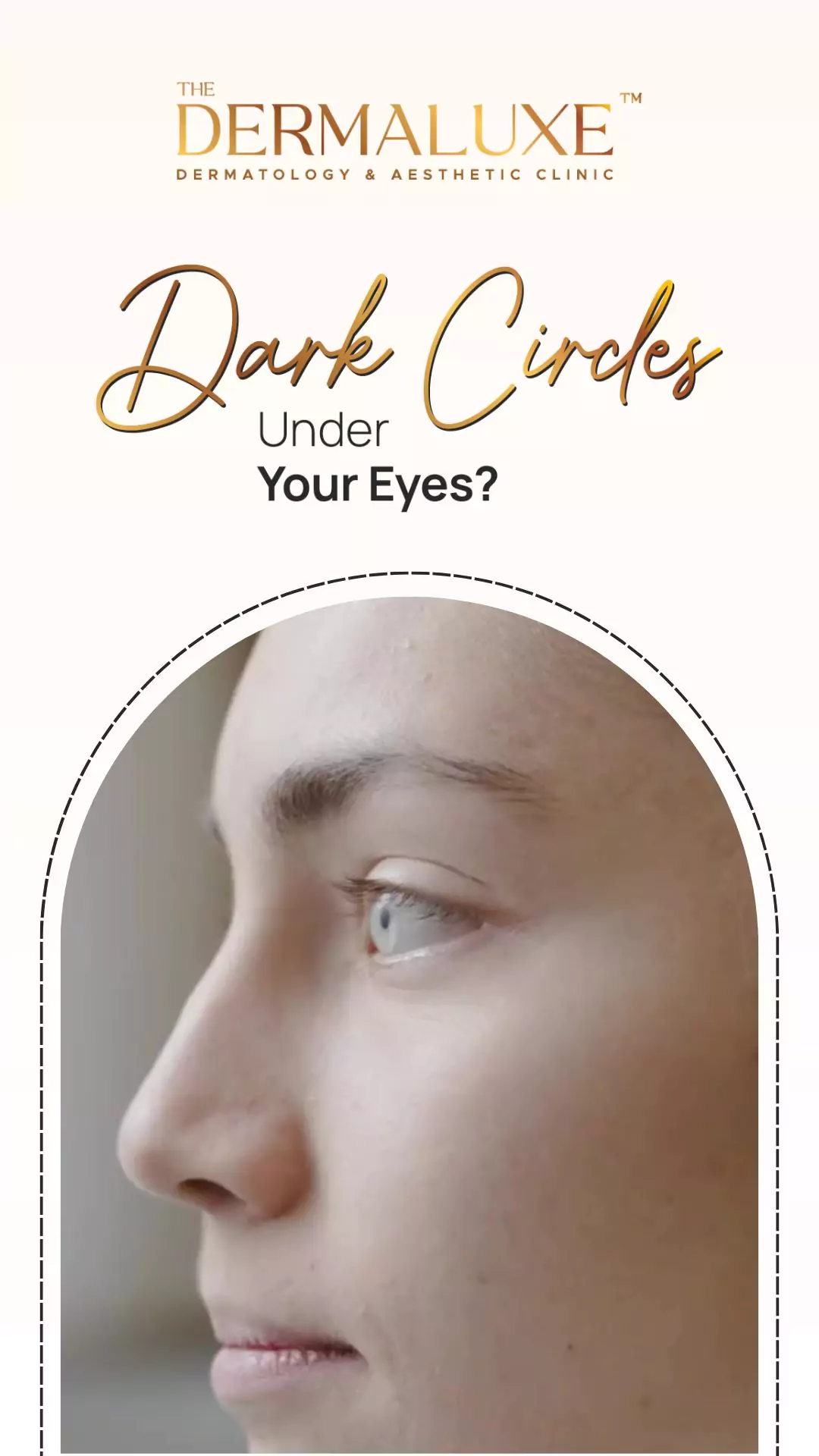 Dark Circles_6july